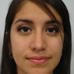 Rhinoplasty Before & After Patient #678