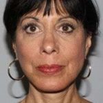 All Me Facelift Before & After Patient #770