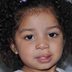 Cleft Lip Palate Before & After Patient #817