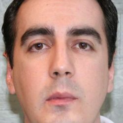 Chin Surgery Before & After Patient #849
