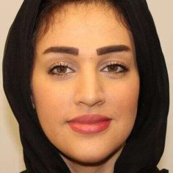 Rhinoplasty Before & After Patient #666