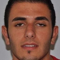 Rhinoplasty Before & After Patient #692